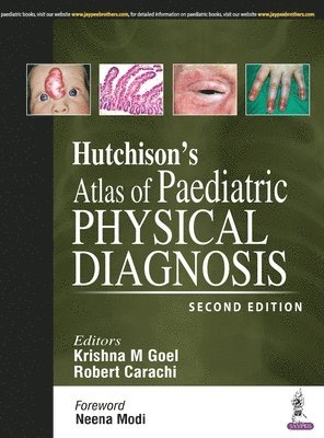 bokomslag Hutchison's Atlas of Paediatric Physical Diagnosis