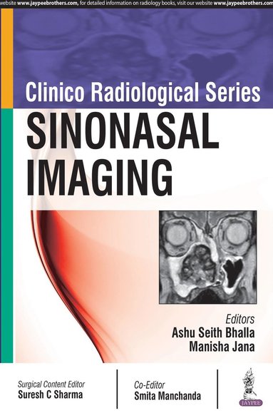 Ashu Seith Bhalla, Manisha Jana - Clinico Radiological Series: Sinonasal Imaging, Häftad