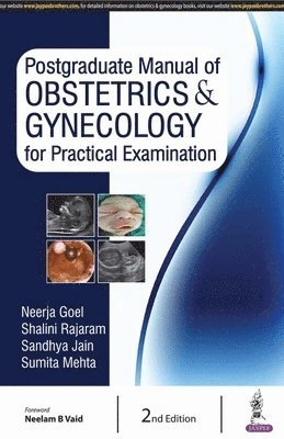 Postgraduate Manual of Obstetrics & Gynecology for Practical Examination 1