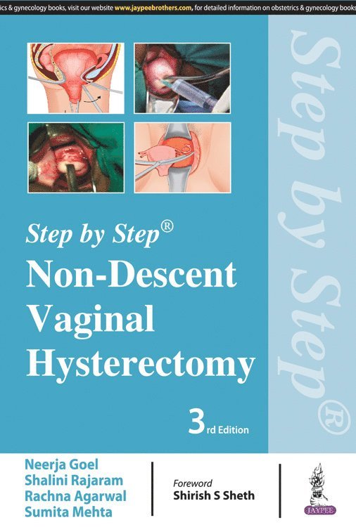Neerja Goel, Shalini Rajaram, Rachna Agarwal, Sumita Mehta - Step by Step: Non-Descent Vaginal Hysterectomy, Häftad