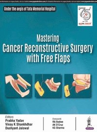 bokomslag Mastering Cancer Reconstructive Surgery with Free Flaps