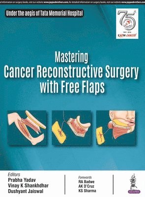 Mastering Cancer Reconstructive Surgery with Free Flaps 1