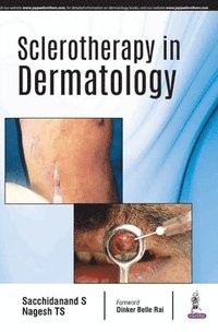 bokomslag Sclerotherapy in Dermatology