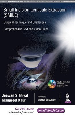 Jeewan S Titiyal, Manpreet Kaur - Small Incision Lenticule Extraction (SMILE): Surgical Technique and Challenges, Inbunden