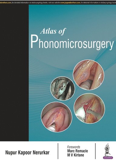 bokomslag Atlas of Phonomicrosurgery