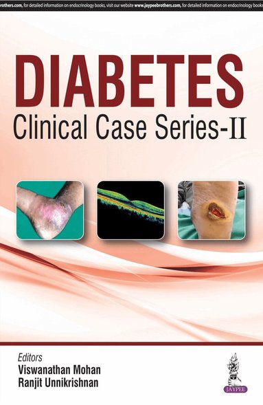 Viswanathan Mohan, Ranjit Unnikrishnan - Diabetes Clinical Case Series – 2, Inbunden