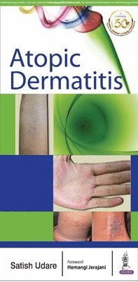 Atopic Dermatitis 1