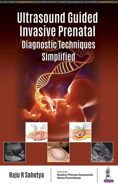 Raju R Sahetya - Ultrasound Guided Invasive Prenatal Diagnostic Techniques Simplified, Häftad