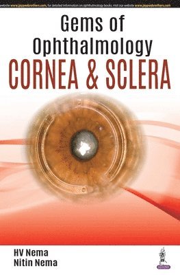 Gems of Ophthalmology: Cornea & Sclera 1