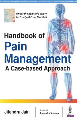 bokomslag Handbook of Pain Management