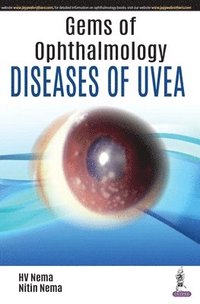 bokomslag Gems of Ophthalmology: Diseases of Uvea