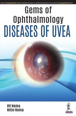 bokomslag Gems of Ophthalmology: Diseases of Uvea