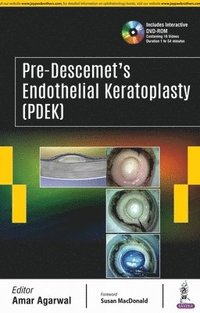 bokomslag Pre-Descemet's Endothelial Keratoplasty (PDEK)