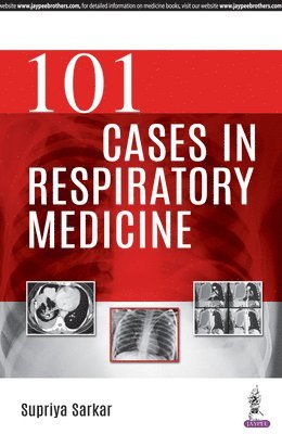 101 Cases in Respiratory Medicine 1