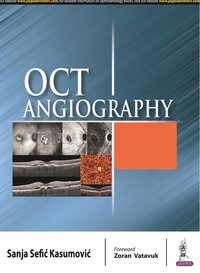 bokomslag OCT Angiography