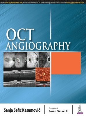 OCT Angiography 1