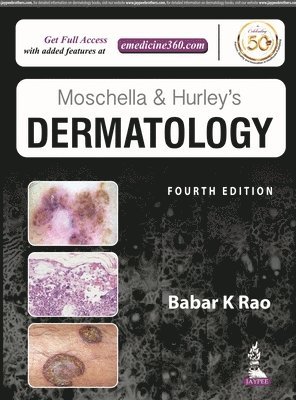 Moschella and Hurley's Dermatology 1