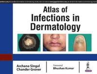 bokomslag Atlas of Infections in Dermatology
