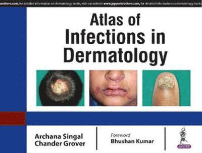 Atlas of Infections in Dermatology 1