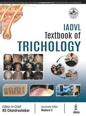 IADVL Textbook of Trichology 1