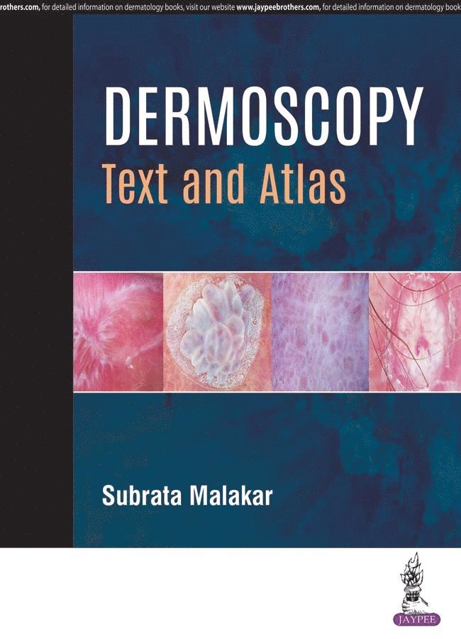 Subrata Malakar - Dermoscopy, Inbunden