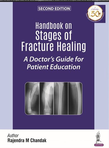 bokomslag Handbook on Stages of Fracture Healing