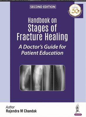 Handbook on Stages of Fracture Healing 1