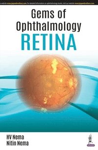 bokomslag Gems of Ophthalmology: Retina