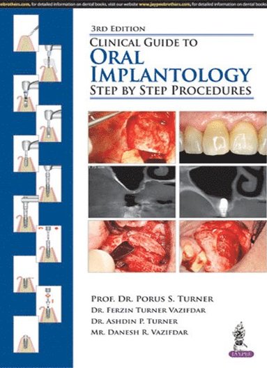 bokomslag Clinical Guide to Oral Implantology