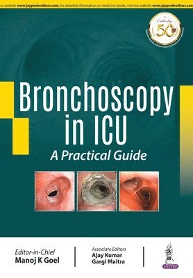 bokomslag Bronchoscopy in ICU: A Practical Guide