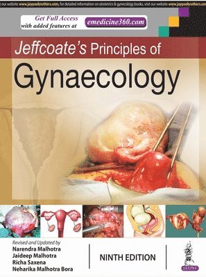 Jeffcoate's Principles of Gynaecology 1