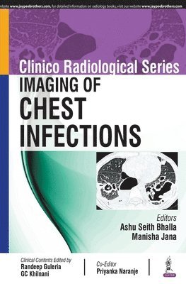 bokomslag Clinico Radiological Series: Imaging of Chest Infections