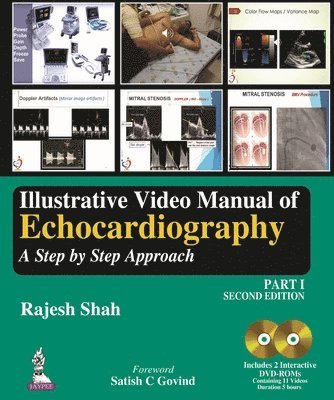 bokomslag Illustrative Video Manual of Echocardiography