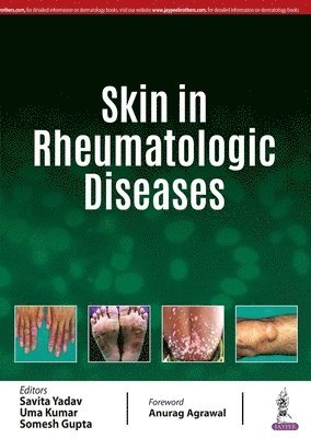 Yadav Savita, Uma Kumar, Somesh Gupta - Skin in Rheumatologic Diseases, Häftad