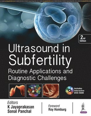 Ultrasound in Subfertility 1