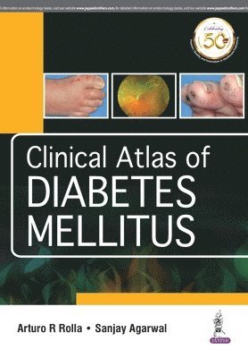Arturo R Rolla, Sanjay Agarwal - Clinical Atlas of Diabetes Mellitus, Häftad