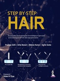 bokomslag Step by Step Hair Transplantation