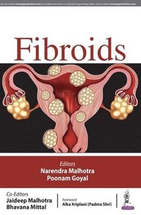 bokomslag FIBROIDS