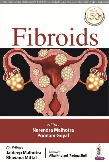 Narendra Malhotra, Poonam Goyal, Jaideep Malhotra, Bhavana Mittal - FIBROIDS, Häftad