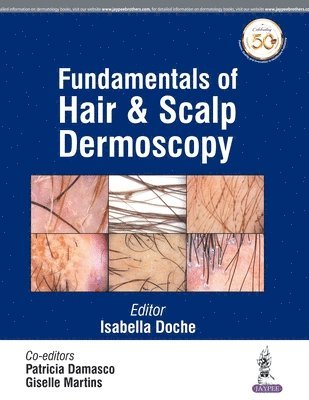 Fundamentals of Hair and Scalp Dermoscopy 1