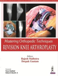 bokomslag Mastering Orthopedic Techniques: Revision Knee Arthroplasty
