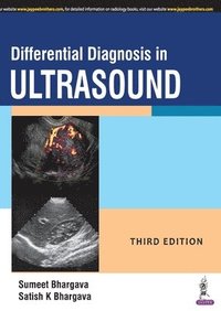 bokomslag Differential Diagnosis in Ultrasound