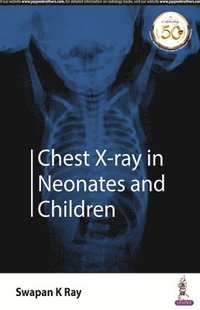 bokomslag Chest X-ray in Neonates and Children