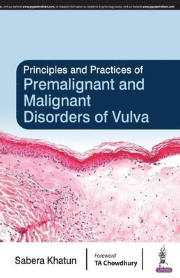 Principles and Practice of Premalignant and Malignant Disorders of Vulva 1