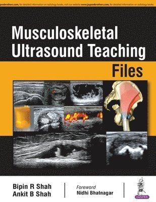 Musculoskeletal Ultrasound Teaching Files 1