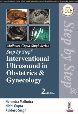 Step by Step Interventional Ultrasound in Obstetrics and Gynecology 1