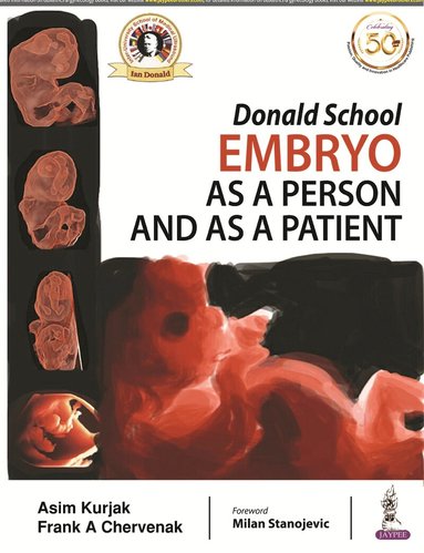 Asim Kurjak, Frank A Chervenak - Donald School Embryo as a Person and as a Patient, Häftad
