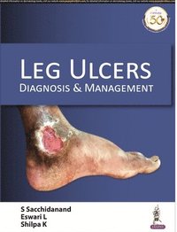 bokomslag Leg Ulcers