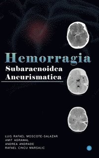 bokomslag Hemorragia Subaracnoidea Aneurismatica