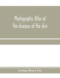 bokomslag Photographic atlas of the diseases of the skin; A Series of Eighty Plates, Comprising more than One Hundred Illustrations, with Descriptive text, and a Treatise on Cutaneous Therapeutics